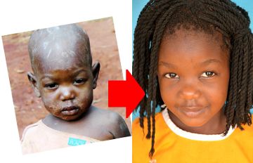 Lazia before and after